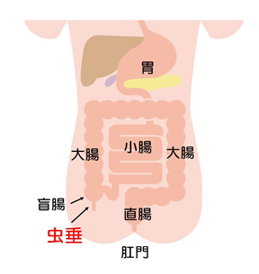  潰瘍性大腸炎