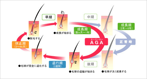 進行を抑えるためには、早めのケアが大切です。