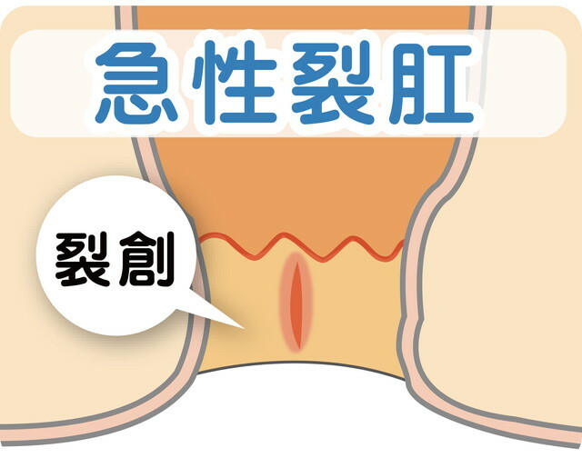 糖尿病の検査